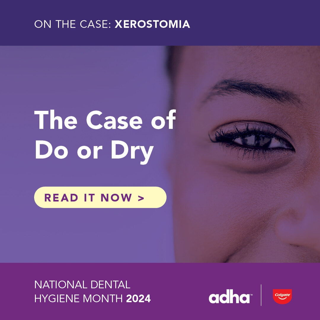 The Case of Do or Dry