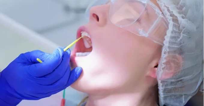 Fluoride varnish on adult patient wearing protective goggles and hairnet